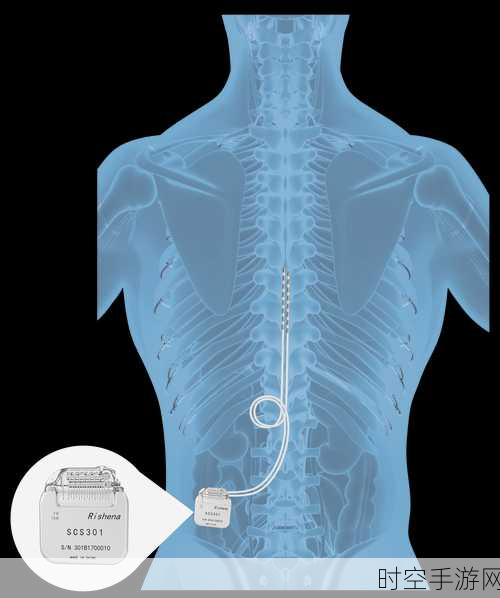 手游科技新突破，脊髓电刺激与外骨骼机器人助力截瘫玩家重燃游戏梦